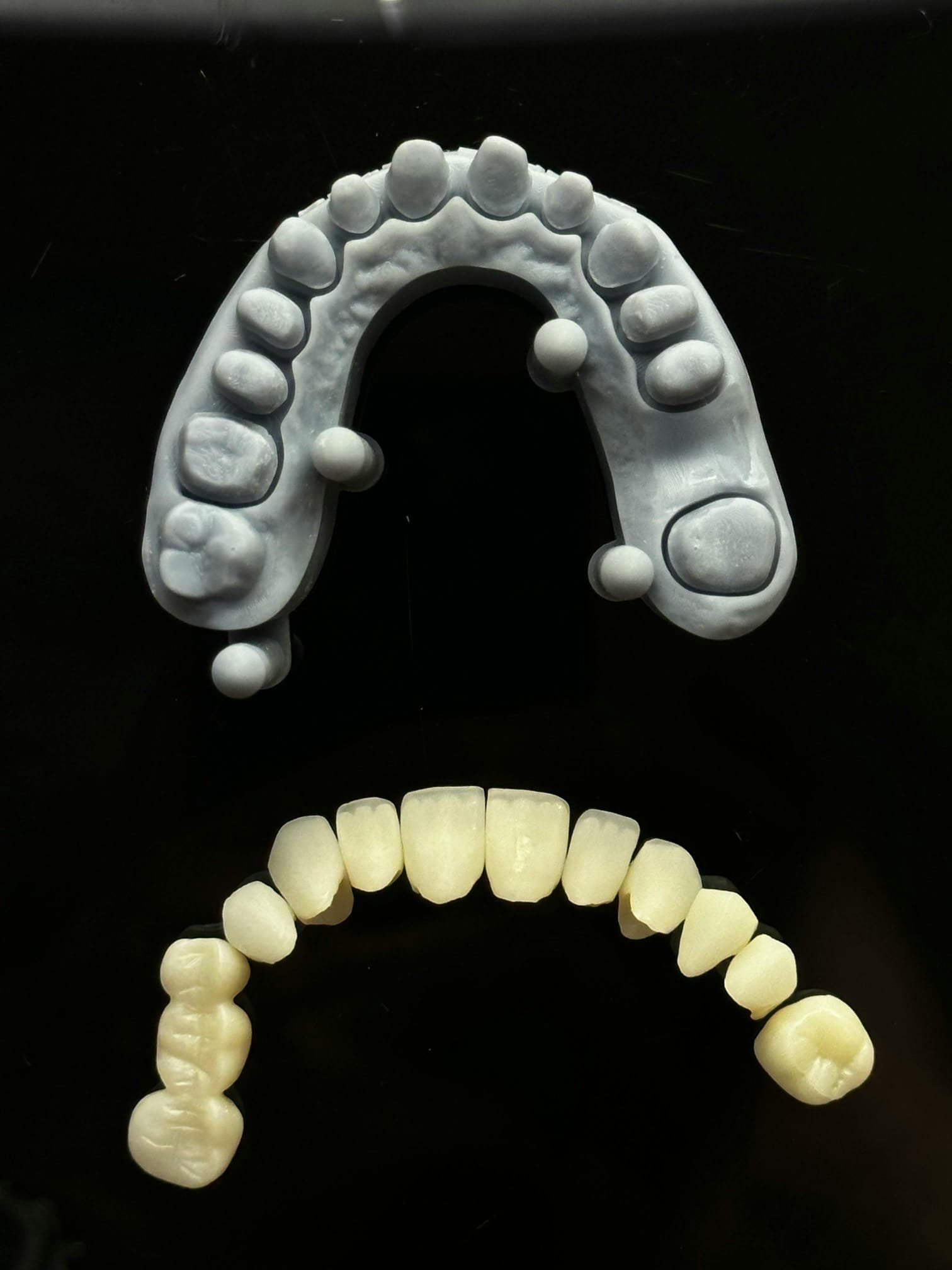 Dental Crowns & Bridges