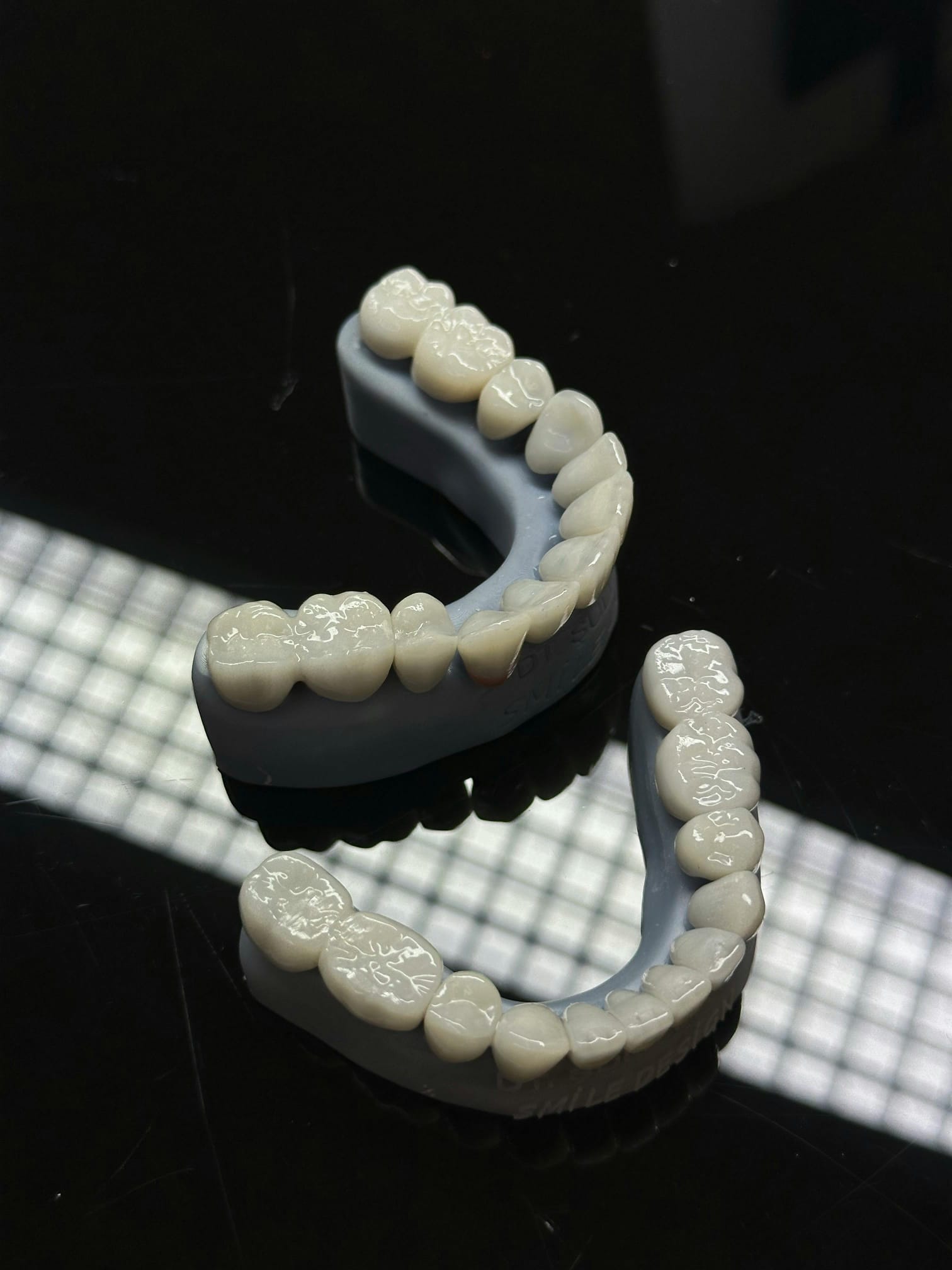 Tooth Bonding & Composite Veneers